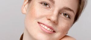 How to Get Rid of Freckles (Update 2025) how to get rid of freckles